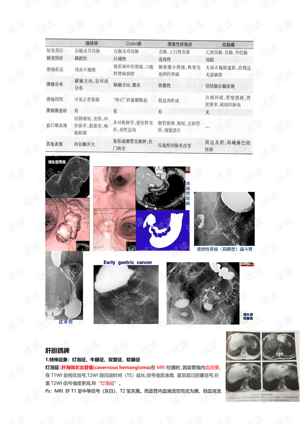 影像学复习重点：X线、CT、MRI特性与比较- CSDN文库